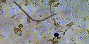 micro organismes et vignes